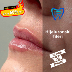 Hijaluronski fileri (Black Friday ponuda)