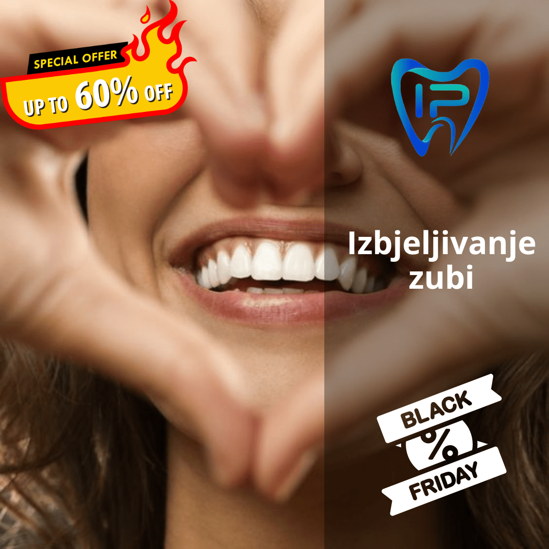 Izbjeljivanje zubi (Black Friday ponuda)