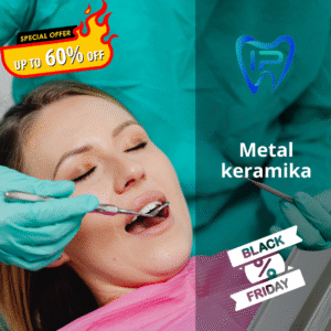 Metalkeramičke krunice – Trajno i pristupačno rješenje za obnovu zubi (Black Friday ponuda)