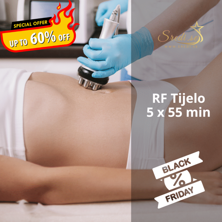 Radiofrekvencija tijela – Paket 5×55 min (Black Friday ponuda)