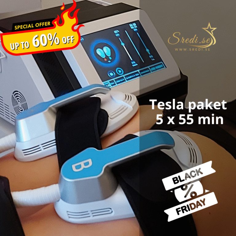 HIEMT Tesla – Paket 5×55 (Black Friday ponuda)