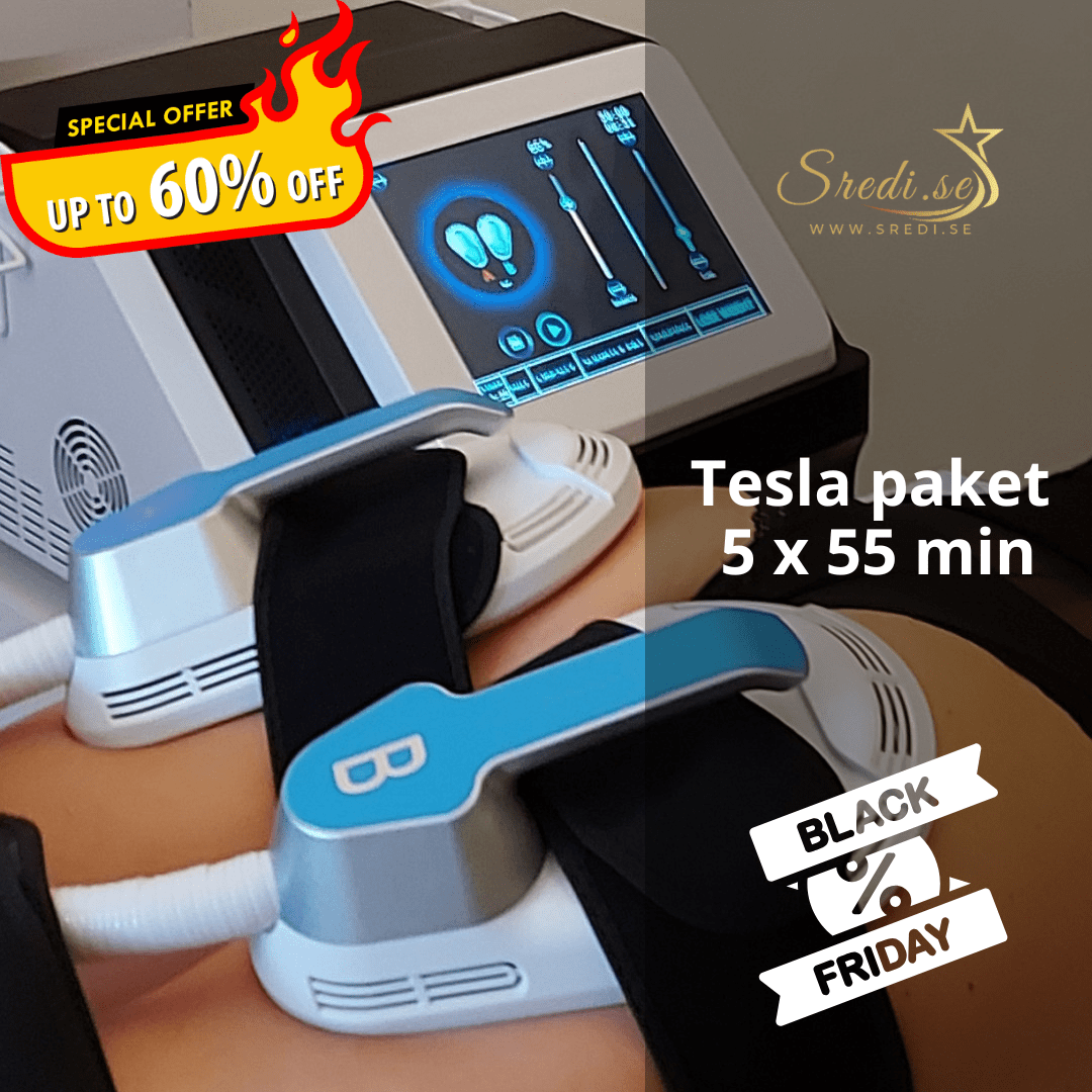 Black Friday u Sredi.se Varaždin – Popusti i do 60% na najtraženije tretmane!