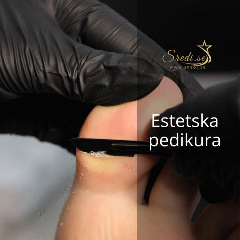 Estetska pedikura